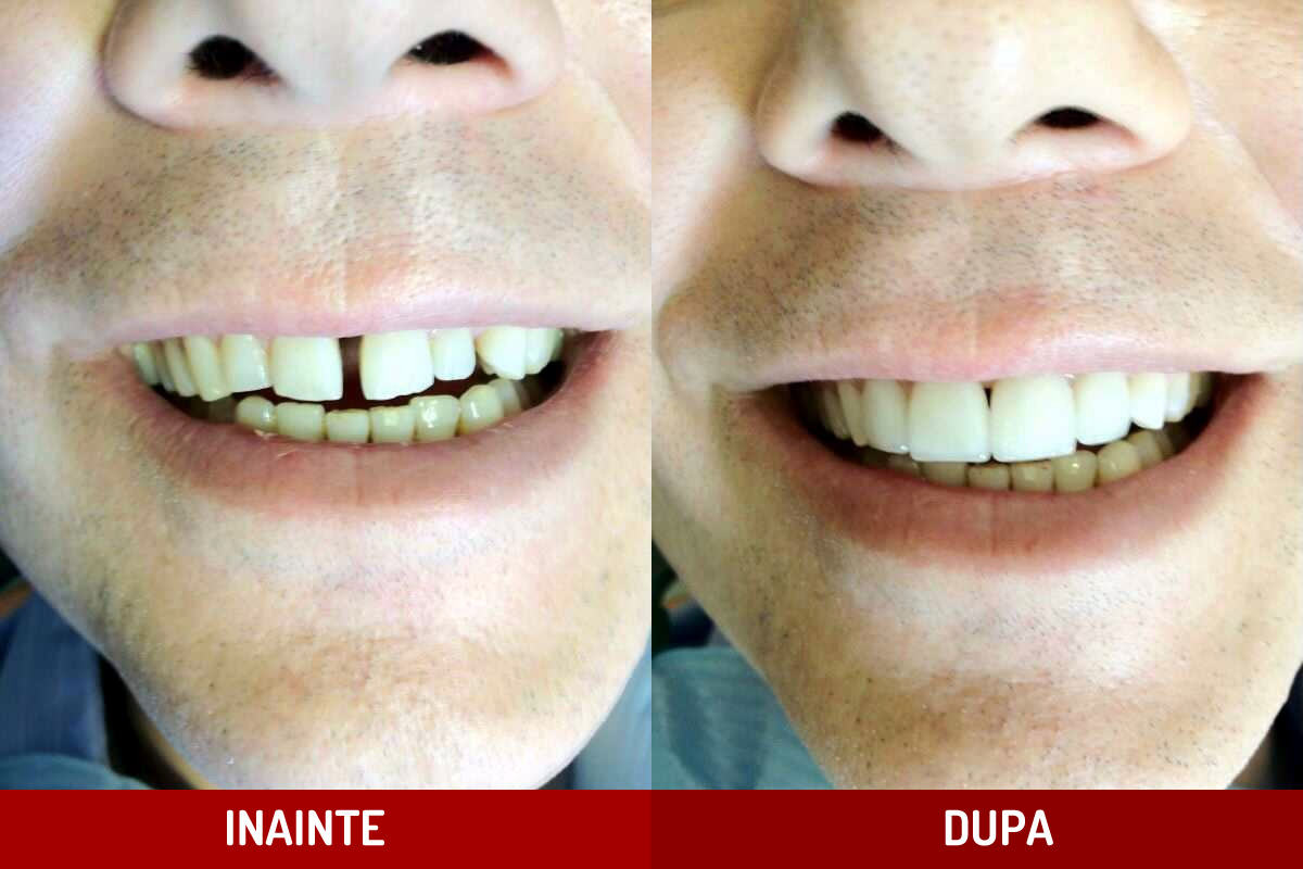 Estetica Dentara Rudent - Cabinet Stomatologic Bucuresti